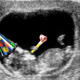Illustration for article titled Sonogram Parties Are the Latest Rage for Self-Important Pregnant Women
